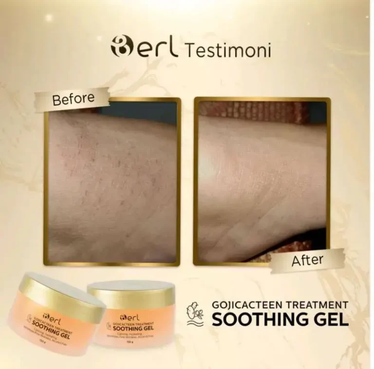 B erl Gojicacteen Treatment Soothing Gel 6