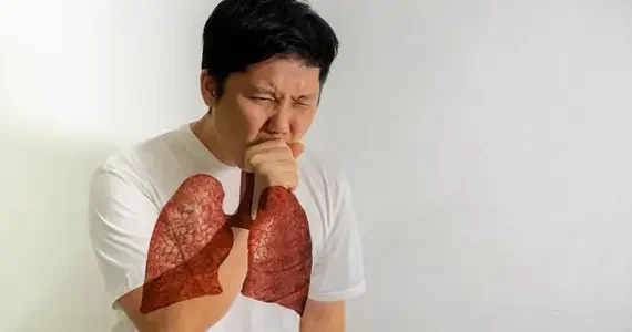 TUBERKULOSIS