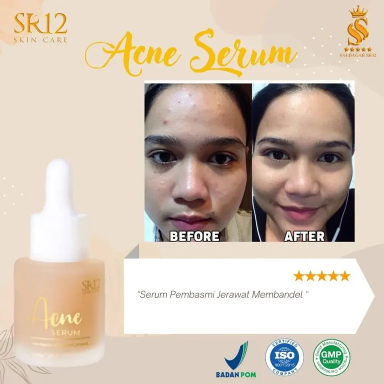 Acne Serum 3
