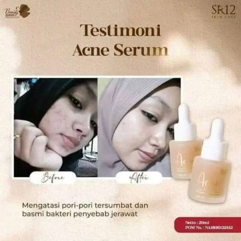 Acne Serum 4