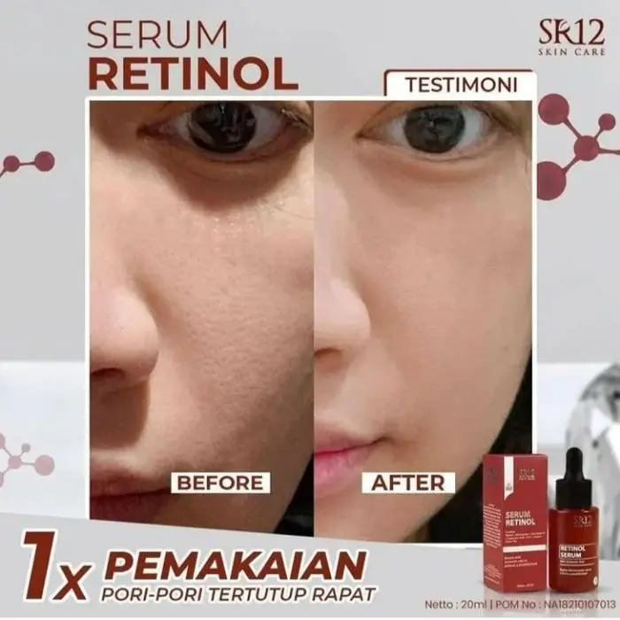 Acne Serum 5