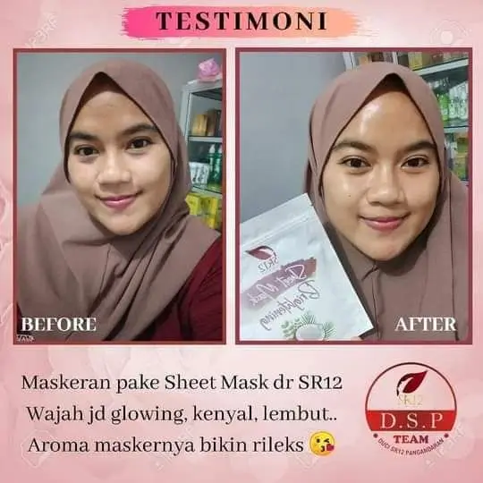 Sheet Mask Acne 5
