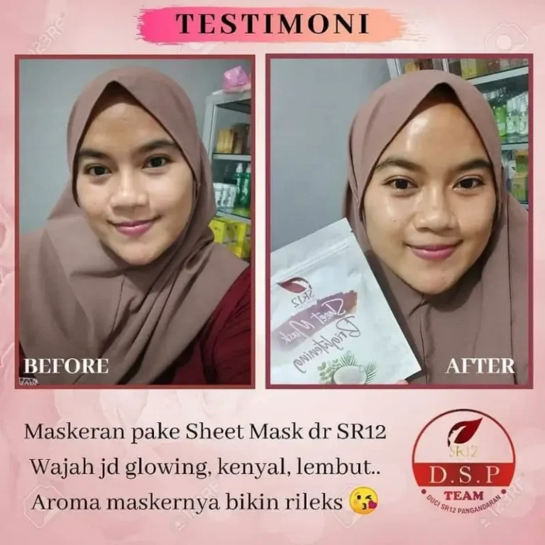 Sheet Mask Brightening 4