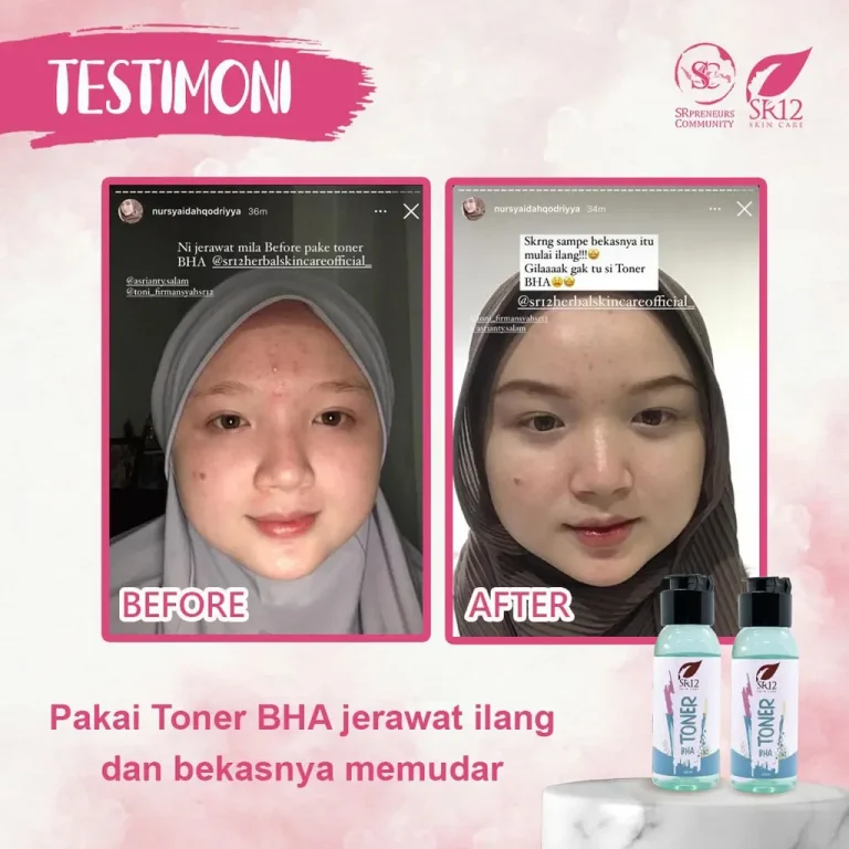 Toner BHA 4
