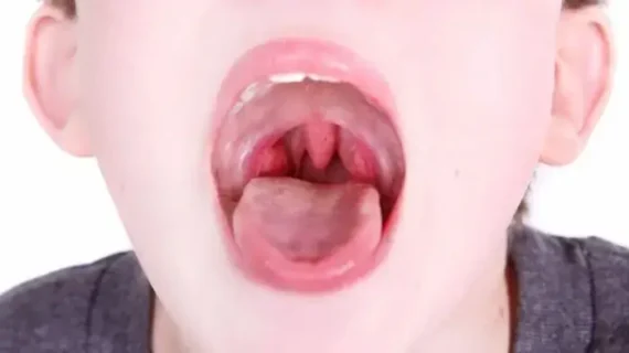 AMANDEL