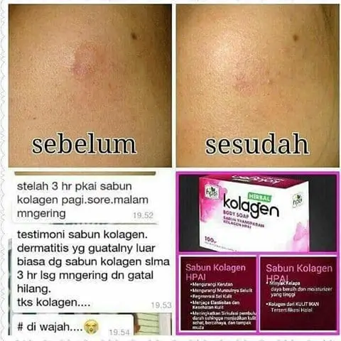 SABUN TRANSPARAN KOLAGEN 5