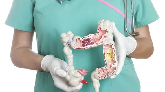 COLON CLEANSING