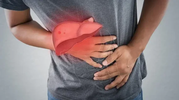 HEPATITIS