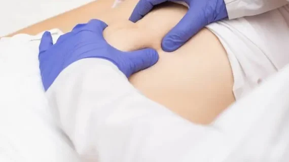 HERNIA