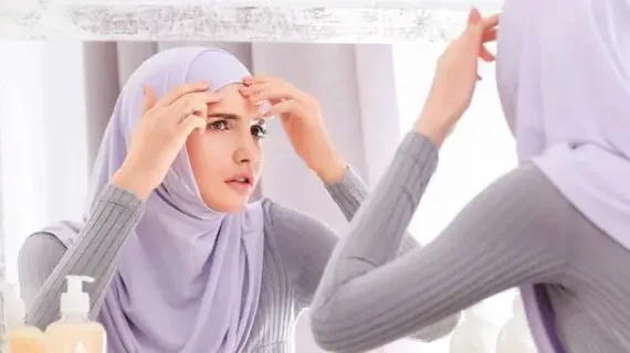 JERAWAT