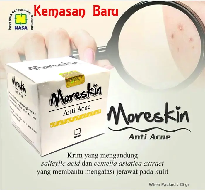 MORESKIN Anti Acne Cream 2