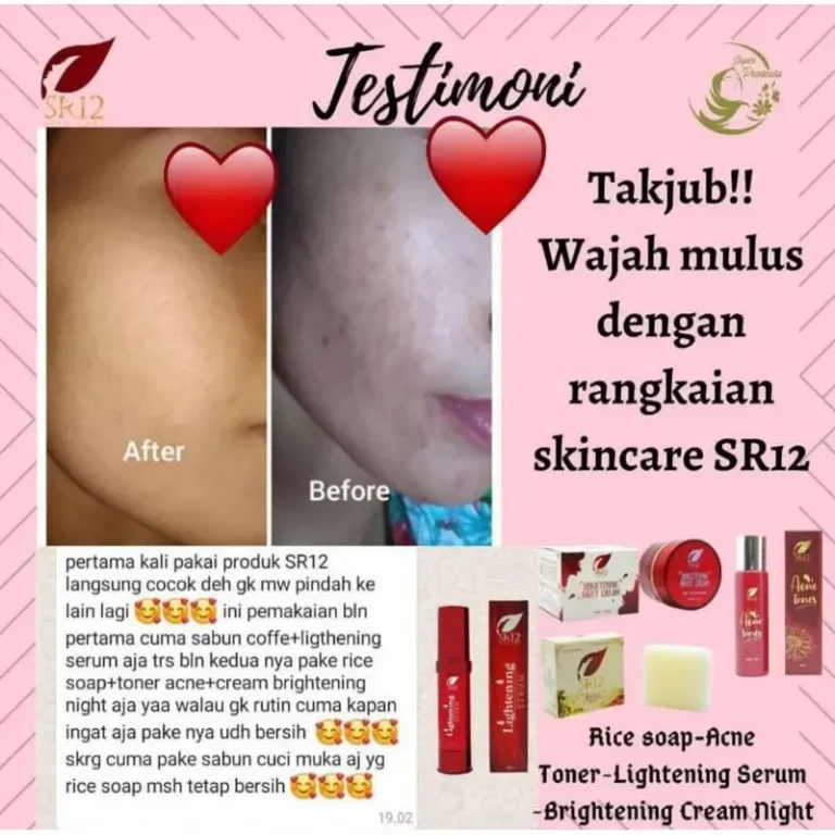 Acne Toner Premium 3