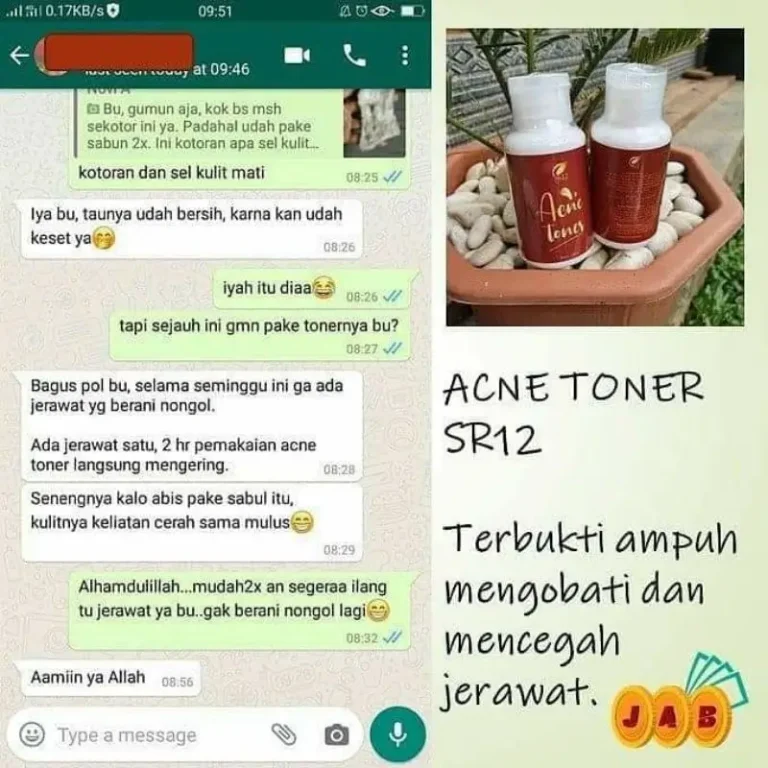 Acne Toner Premium 5