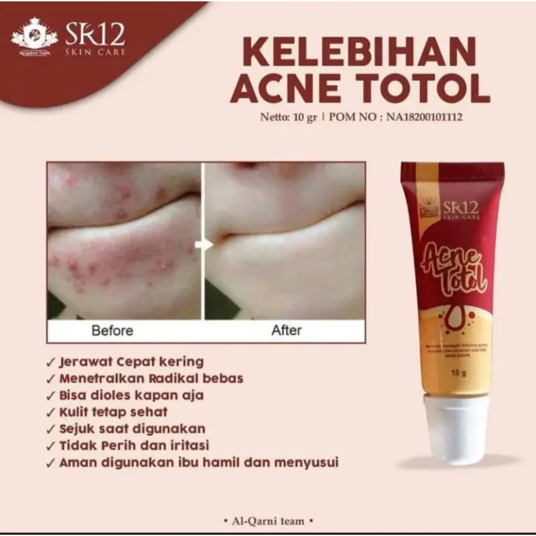 Acne Totol 4